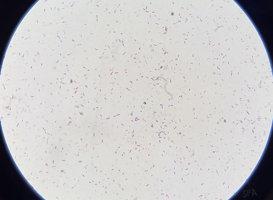 17. Gram Positive Bacilli  Microscopic